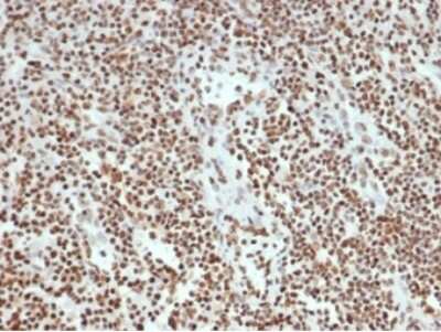 Immunohistochemistry-Paraffin: Ku80/XRCC5 Antibody (XRCC5/7315) - Azide and BSA Free [NBP3-14017] - Formalin-fixed, paraffin-embedded human lymph node stained with Ku80/XRCC5 antibody (XRCC5/7315). HIER: Tris/EDTA, pH9.0, 45min. HRP-polymer, 30min. DAB, 5min.
