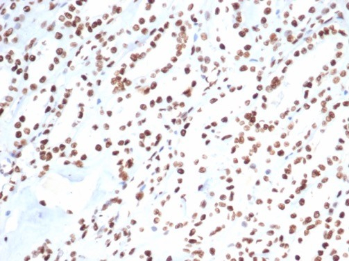 Formalin-fixed, paraffin-embedded human kidney stained with Ku80/XRCC5 antibody (XRCC5/7317). HIER: Tris/EDTA, pH9.0, 45min. Secondary: HRP-polymer, 30min. DAB, 5min.