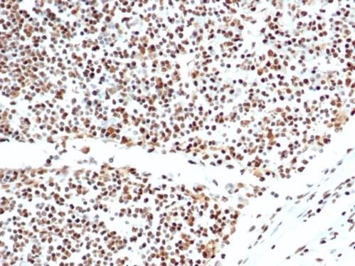 Formalin-fixed, paraffin-embedded human lymph node stained with Ku80/XRCC5 antibody (XRCC5/7317). HIER: Tris/EDTA, pH9.0, 45min. Secondary: HRP-polymer, 30min. DAB, 5min.