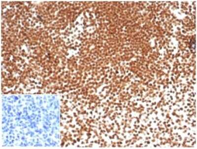 Immunohistochemistry-Paraffin: NPM1 Antibody (NPM1/7072R) - Azide and BSA Free [NBP3-14019] - Formalin-fixed, paraffin-embedded human tonsil stained with NPM1 antibody (NPM1/7072R). Inset: PBS instead of primary antibody; secondary only negative control.