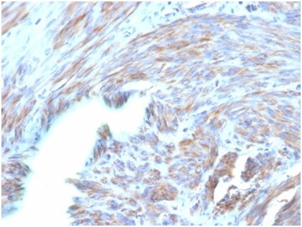 Formalin-fixed, paraffin-embedded human uterusstained with BNP antibody (NPPB/4493). HIER: Tris/EDTA, pH9.0, 45min. Secondary: HRP-polymer, 30min. DAB, 5min.