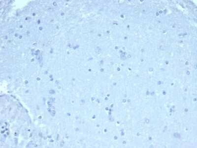 Immunohistochemistry-Paraffin: FoxP1 Antibody (rFOXP1/6902) - Azide and BSA Free [NBP3-14022] - IHC analysis of formalin-fixed, paraffin-embedded human brain. Negative tissue control. FoxP1 antibody (rFOXP1/6902) at 1ug/ml in PBS for 30min RT. HIER: Tris/EDTA, pH9.0, 45min. HRP-polymer, 30min. DAB, 5min.