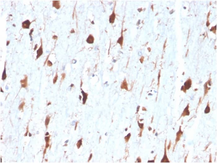 Formalin-fixed, paraffin-embedded human brain stained with Carbonic Anhydrase VIII/CA8 Antibody (CA8/6572) - Azide and BSA Free.