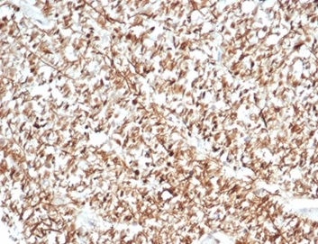 Formalin-fixed, paraffin-embedded human brain stained with Calretinin antibody (CALB2/7029R). HIER: Tris/EDTA, pH9.0, 45min. Secondary: HRP-polymer, 30min. DAB, 5min.