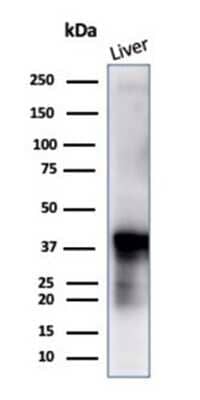 Western Blot: Glutamine Synthetase Antibody (GLUL/6604) - Azide and BSA Free [NBP3-14039] - Western blot analysis of human liver tissue using Glutamine Synthetase antibody (GLUL/6604).