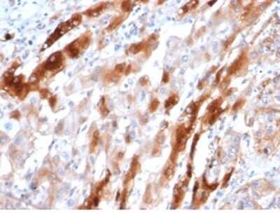Immunohistochemistry-Paraffin: Glutamine Synthetase Antibody (GLUL/6604) - Azide and BSA Free [NBP3-14039] - Formalin-fixed, paraffin-embedded human liver stained with Glutamine Synthetase antibody (GLUL/6604) at 2ug/ml. HIER: Tris/EDTA, pH9.0, 45min. HRP-polymer, 30min. DAB, 5min.