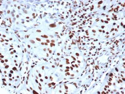 Immunohistochemistry-Paraffin: HIST1H3A [p Ser10] Antibody (rPHH3/6824) - Azide and BSA Free [NBP3-14043] - Formalin-fixed, paraffin-embedded human bladder stained with HIST1H3A [p Ser10] antibody (rPHH3/6824).