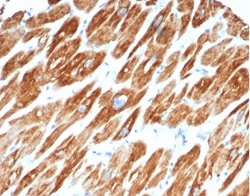 Formalin-fixed, paraffin-embedded human cardiac muscle stained with Desmin antibody (DES/3255) at 2ug/ml. HIER: Tris/EDTA, pH9.0, 45min. Secondary: HRP-polymer, 30min. DAB, 5min.