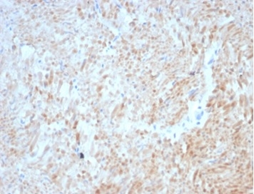 Formalin-fixed, paraffin-embedded cat smooth muscle stained with Desmin antibody (DES/3255) at 2ug/ml. HIER: Tris/EDTA, pH9.0, 45min. Secondary: HRP-polymer, 30min. DAB, 5min.