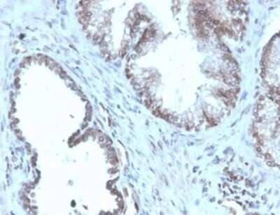 Immunohistochemistry-Paraffin: SLC45A3/Prostein Antibody (SLC45A3/4965R) - Azide and BSA Free [NBP3-14048] - Formalin-fixed, paraffin-embedded human prostate stained with SLC45A3/Prostein antibody (SLC45A3/4965R).