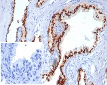 Formalin-fixed, paraffin-embedded human prostate stained with SLC45A3/Prostein Antibody (SLC45A3/7176R) - Azide and BSA Free. Inset: PBS instead of primary antibody; secondary only negative control.