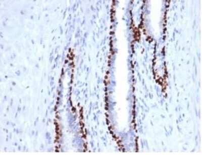 Immunohistochemistry-Paraffin: p40/deltaNp63 Antibody (P40/4396R) - Azide and BSA Free [NBP3-14050] - Formalin-fixed, paraffin-embedded human prostate stained with p40/deltaNp63 antibody (P40/4396R).