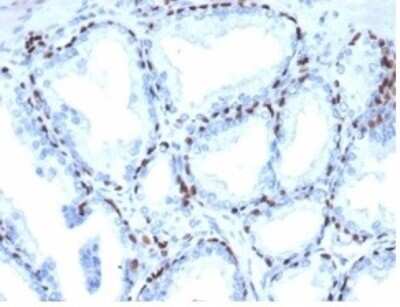 Immunohistochemistry-Paraffin: p40/deltaNp63 Antibody (P40/4396R) - Azide and BSA Free [NBP3-14050] - Formalin-fixed, paraffin-embedded human prostate stained with p40/deltaNp63 antibody (P40/4396R).