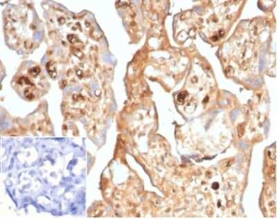 Immunohistochemistry-Paraffin: alpha-Fetoprotein/AFP Antibody (AFP/7007R) - Azide and BSA Free [NBP3-14053] - IHC analysis of formalin-fixed, paraffin-embedded human placenta. Cytoplasmic staining using alpha-Fetoprotein/AFP antibody (AFP/7007R) at 2ug/ml in PBS for 30min RT. Inset: PBS instead of primary antibody, secondary only negative control.