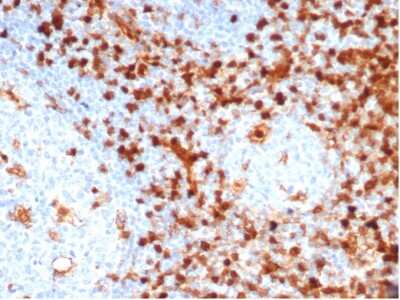 Immunohistochemistry-Paraffin: Annexin A1 Antibody (ANXA1/6452R) - Azide and BSA Free [NBP3-14056] - Formalin-fixed, paraffin-embedded human tonsil stained with Annexin A1 antibody (ANXA1/6452R).