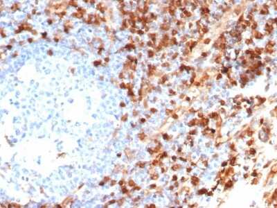 Immunohistochemistry-Paraffin: Annexin A1 Antibody (ANXA1/6452R) - Azide and BSA Free [NBP3-14056] - Formalin-fixed, paraffin-embedded human tonsil stained with Annexin A1 antibody (ANXA1/6452R).