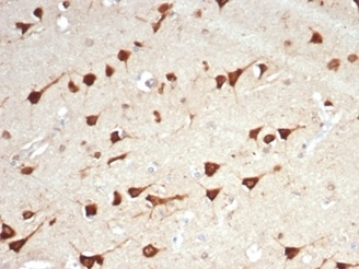Formalin-fixed, paraffin-embedded human brain stained with BPIFB1 antibody (LPLUNC1/7059R). HIER: Tris/EDTA, pH9.0, 45min. Secondary: HRP-polymer, 30min. DAB, 5min.