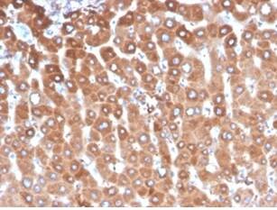 Formalin-fixed, paraffin-embedded human liver stained with Haptoglobin Antibody (HP/3837) - Azide and BSA Free at 2ug/ml.