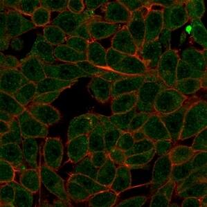 Immunofluorescence Analysis of PFA-fixed HeLa cells stained using MED7 Antibody (PCRP-MED7-1B8) - Azide and BSA Free followed by goat anti-mouse IgG-CF488 (green). CF640R phalloidin (red).