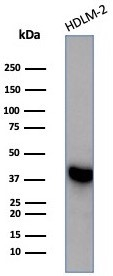 Western blot analysis of HDLM-2 cell lysate using STING/TMEM173 antibody (STING1/7431).