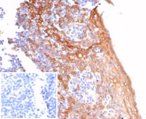 Formalin-fixed, paraffin-embedded human tonsil stained with STING/TMEM173 antibody (STING1/7431).Inset: PBS instead of primary antibody; secondary only negative control
