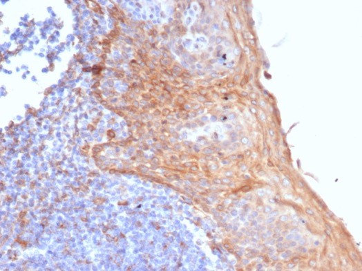 Formalin-fixed, paraffin-embedded human tonsil stained with STING/TMEM173 antibody (STING1/7431). HIER: Tris/EDTA, pH9.0, 45min. Secondary: HRP-polymer, 30min. DAB, 5min .