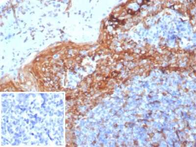 Immunohistochemistry-Paraffin: STING/TMEM173 Antibody (STING1/7432) - Azide and BSA Free [NBP3-14077] - Formalin-fixed, paraffin-embedded human tonsil stained with STING/TMEM173 antibody (STING1/7432). Inset: PBS instead of primary antibody; secondary only negative control.