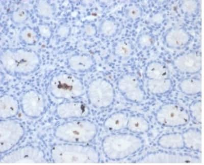 Immunohistochemistry-Paraffin: Catalase Antibody (HPYL/7171) - (H. pylori) - Azide and BSA Free [NBP3-14082] - Formalin-fixed, paraffin-embedded human H. pylori-infected stomach stained with Catalase antibody (HPYL/7171) - (H. pylori).
