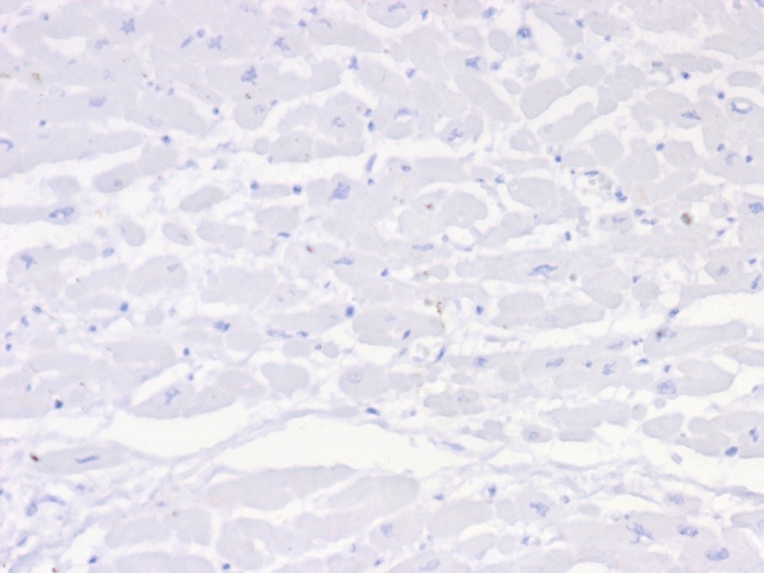 Formalin-fixed, paraffin-embedded human heart stained with Negative Control for Mouse Monoclonal antibody (IGG1/453). HIER: Tris/EDTA, pH9.0, 45min. Secondary: HRP-polymer, 30min. DAB, 5min.