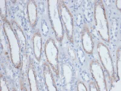 Immunohistochemistry-Paraffin: Biotin (Vitamin B7 or Vitamin H) Antibody (BTN/403) - Azide and BSA Free [NBP3-14087] - Formalin-fixed, paraffin-embedded human kidney. Endogenous biotin stained with Biotin (Vitamin B7 or Vitamin H) antibody (BTN/403).