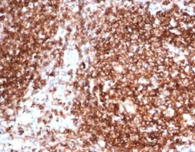 Immunohistochemistry-Paraffin: HLA DQ/DR/DP Antibody (HLA-Pan/6663) - Azide and BSA Free [NBP3-14091] - Formalin-fixed, paraffin-embedded human tonsil stained with HLA DQ/DR/DP antibody (HLA-Pan/6663).