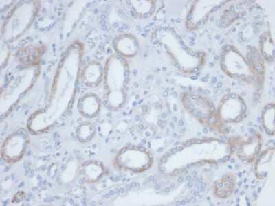 Immunohistochemistry-Paraffin: Biotin (Vitamin B7 or Vitamin H) Antibody (BTN/36) - Azide and BSA Free [NBP3-14093] - Formalin-fixed, paraffin-embedded human kidney. Endogenous biotin stained with Biotin (Vitamin B7 or Vitamin H) antibody (BTN/36).