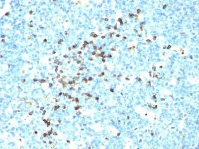 Immunohistochemistry-Paraffin: IgG Heavy Chain Antibody (IG217 + IG266) - Azide and BSA Free [NBP3-14095] - Formalin-fixed, paraffin-embedded human Tonsil stained with IgG Heavy Chain antibody (IG217 + IG266)