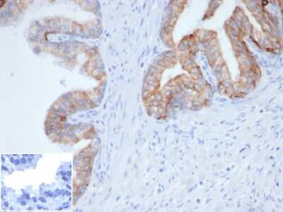 Immunohistochemistry-Paraffin: Cytokeratin, pan Antibody (Cocktail PCK/4933R) - Azide and BSA Free [NBP3-14098] - Formalin-fixed, paraffin-embedded human prostate stained with Cytokeratin, pan antibody (Cocktail PCK/4933R). Inset: PBS instead of primary antibody, secondary control.