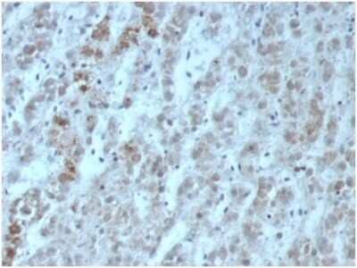 Immunohistochemistry-Paraffin: IL-15 Antibody (IL15/6971R) - Azide and BSA Free [NBP3-14101] - Formalin-fixed, paraffin-embedded human adrenal glandstained with IL-15 antibody (IL15/6971R). HIER: Tris/EDTA, pH9.0, 45min. HRP-polymer, 30min. DAB, 5min.