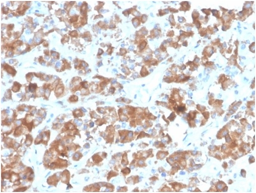 Formalin-fixed, paraffin-embedded human pituitary stained with LH beta antibody (rLHb/1613). HIER: Tris/EDTA, pH9.0, 45min. Secondary: HRP-polymer, 30min. DAB, 5min.