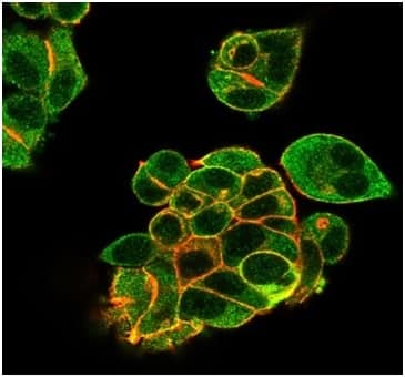 Immunofluorescence Analysis of PFA-fixed MCF-7 cells stained using Lactoferrin Antibody (LTF/4082) - Azide and BSA Free