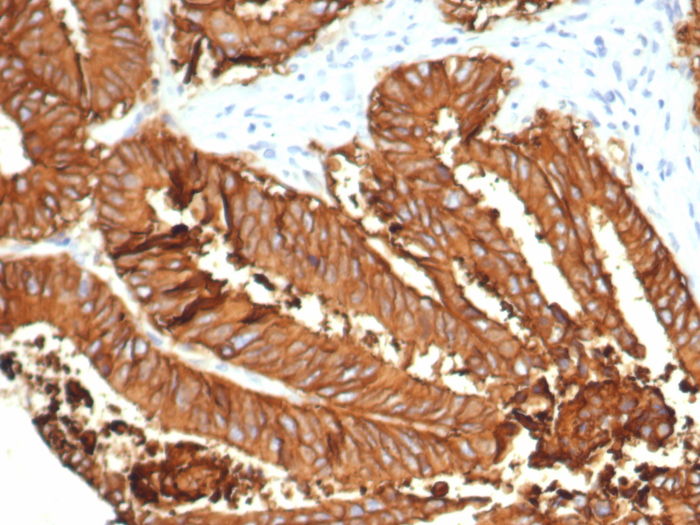 Formalin-fixed, paraffin-embedded human small intestine stained with Smad4 antibody (SMAD/6309R). HIER: Tris/EDTA, pH9.0, 45min. Secondary: HRP-polymer, 30min. DAB, 5min.