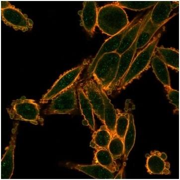 Immunofluorescence Analysis of PFA-fixed HeLa cells stained using Smad9 Antibody (PCRP-SMAD9-2F4) - Azide and BSA Free followed by goat anti-mouse IgG-CF488 (green). CF640A phalloidin (red).