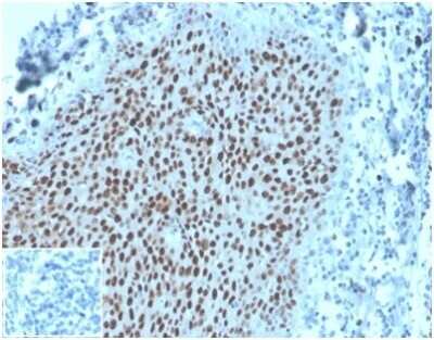 Immunohistochemistry-Paraffin: MCM2 Antibody (MCM2/3678) - Azide and BSA Free [NBP3-14118] - Formalin-fixed, paraffin-embedded human tonsil stained with MCM2 antibody (MCM2/3678). Inset: PBS instead of primary antibody, secondary only control.