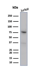 Western blot analysis of Jurkat cell lysate using MLH1 antibody (MLH1/6284R).
