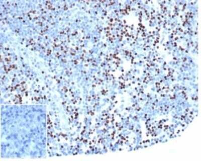 Immunohistochemistry-Paraffin: LEF1 Antibody (rLEF1/6906) - Azide and BSA Free [NBP3-14130] - IHC analysis of formalin-fixed, paraffin-embedded human lymph node. Strong nuclear staining of non-germinal center cells using LEF1 antibody (rLEF1/6906) at 2ug/ml in PBS for 30min RT. Inset: PBS instead of primary. Secondary antibody negative control.