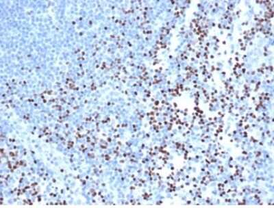 Immunohistochemistry-Paraffin: LEF1 Antibody (rLEF1/6906) - Azide and BSA Free [NBP3-14130] - IHC analysis of formalin-fixed, paraffin-embedded human lymph node. Strong nuclear staining of non-germinal center cells using LEF1 antibody (rLEF1/6906) at 2ug/ml in PBS for 30min RT. HIER: Tris/EDTA, pH9.0, 45min. HRP-polymer, 30min. DAB, 5min.