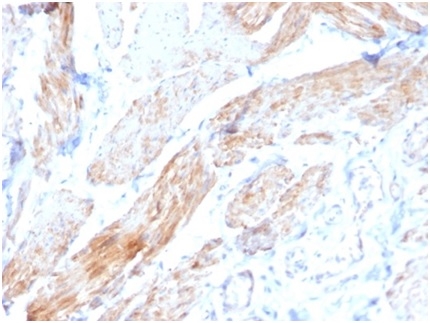 Formalin-fixed, paraffin-embeddedhuman bladderstained with Phosphoglucomutase 5 antibody (PGM5/3552) at 2ug/ml. HIER: Tris/EDTA, pH9.0, 45min. Secondary: HRP-polymer, 30min. DAB, 5min.