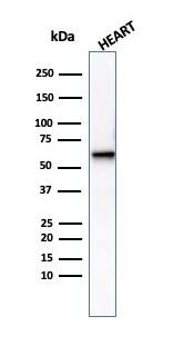 Western Blot Analysis of human heart tissue lysate using Phosphoglucomutase 5 Antibody (PGM5/3552) - Azide and BSA Free.