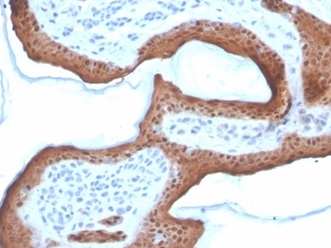 Formalin-fixed, paraffin-embedded human skin stained with Serpin B5/Maspin antibody (SERPINB5/4972). HIER: Tris/EDTA, pH9.0, 45min. Secondary: HRP-polymer, 30min. DAB, 5min