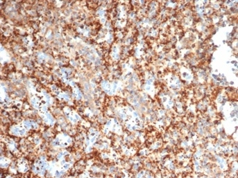 Formalin-fixed, paraffin-embedded human spleen stained with PI 3-Kinase p85 beta antibody (PIK3R2/292). HIER: Tris/EDTA, pH9.0, 45min. Secondary: HRP-polymer, 30min. DAB, 5min.
