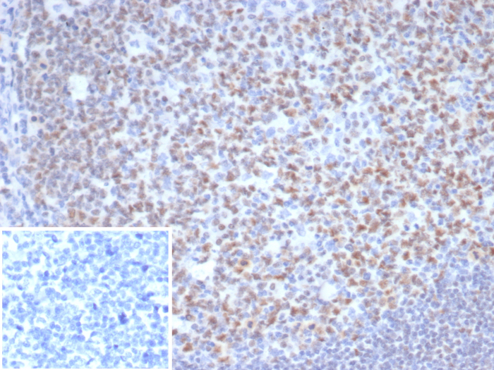 Formalin-fixed, paraffin-embedded human tonsil stained with OCT2 antibody (OCT2/7073R). Inset: PBS instead of primary antibody; secondary only negative control.