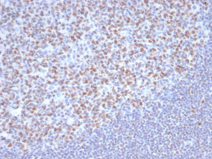 Formalin-fixed, paraffin-embedded human tonsil stained with OCT2 antibody (OCT2/7073R). HIER: Tris/EDTA, pH9.0, 45min. Secondary: HRP-polymer, 30min. DAB, 5min.