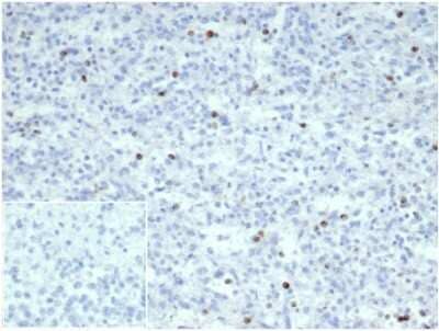 Immunohistochemistry-Paraffin: Perforin Antibody (PRF1/7077R) - Azide and BSA Free [NBP3-14154] - Formalin-fixed, paraffin-embedded human spleen stained with Perforin antibody (PRF1/7077R). Inset: PBS instead of primary antibody; secondary only negative control.